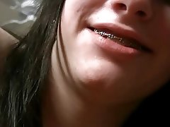 Young Teen with Braces 